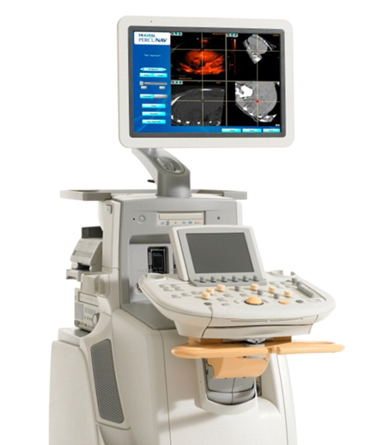 ULTRASOUND SCANNERS
